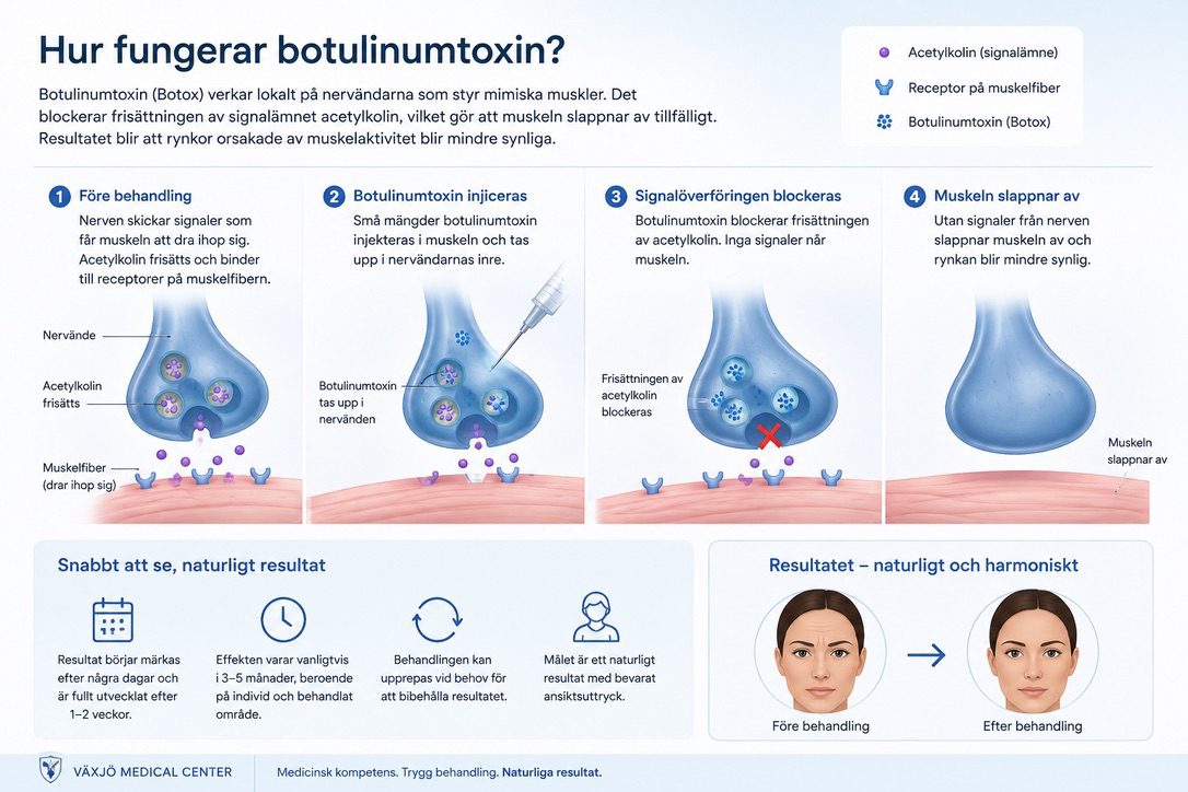 Illustration som visar hur botulinumtoxin blockerar nervsignaler till ansiktsmuskler vid Botoxbehandling i Växjö.