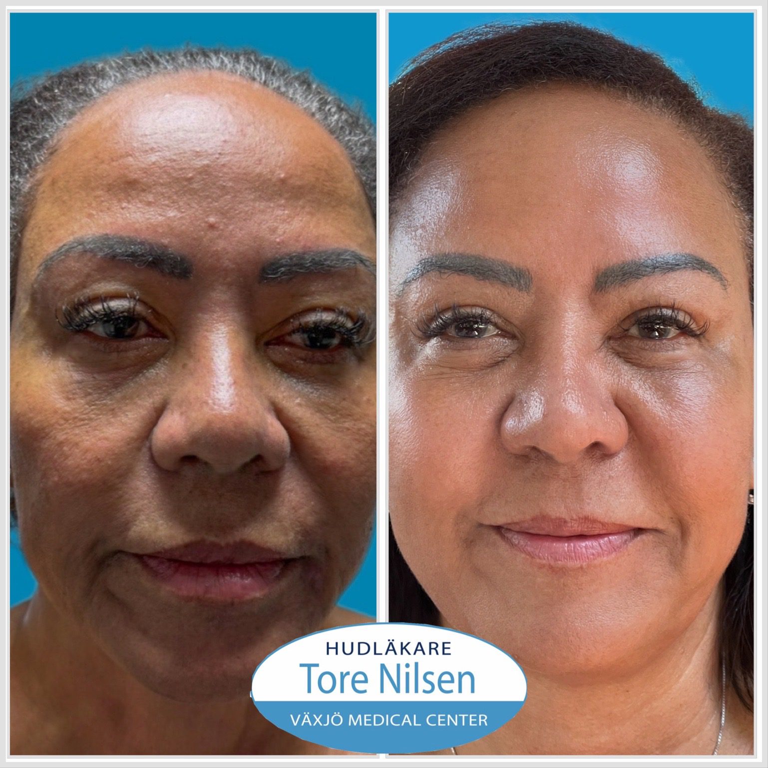 Dr Tores Signaturbehandling