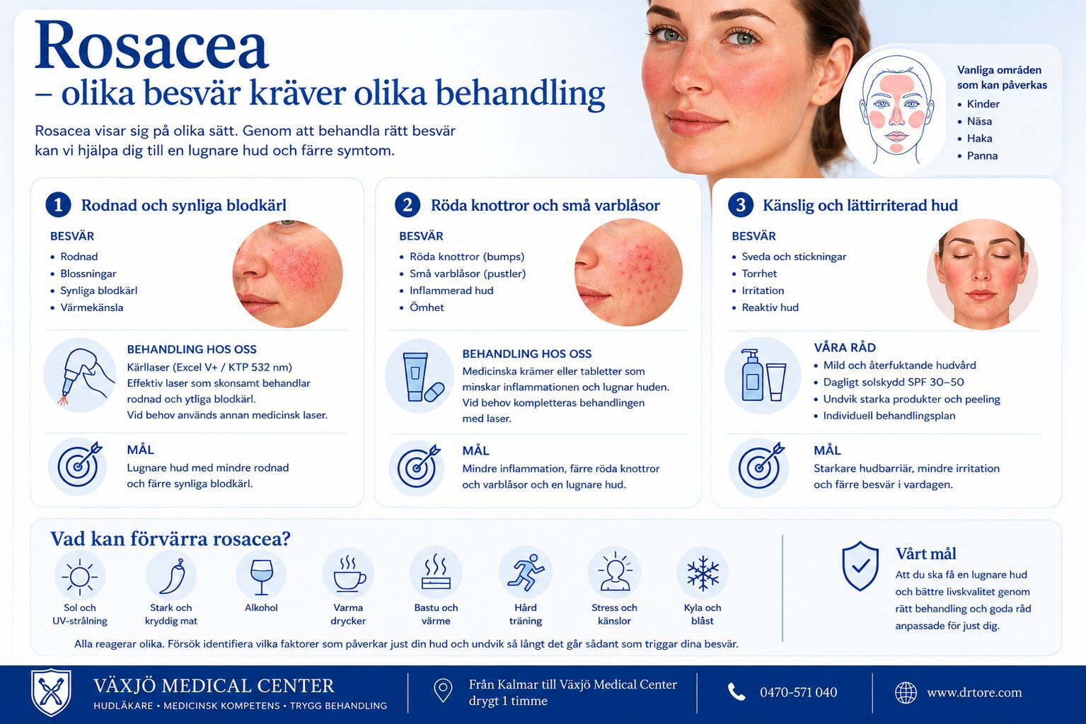 Illustration som förklarar rosacea, vanliga symtom, utlösande faktorer och behandlingsmöjligheter