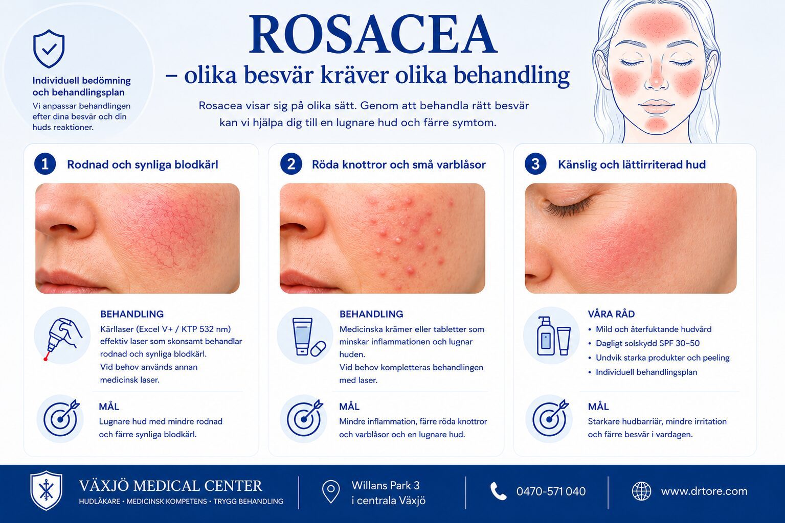 Illustration som visar olika typer av rosacea, vanliga symtom och behandlingsalternativ.